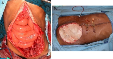 gay boys with six packs ethical casesin transgender surgury for minors